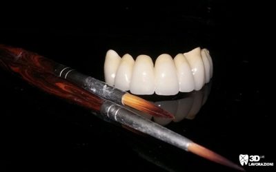 Metallo – ceramica 📍