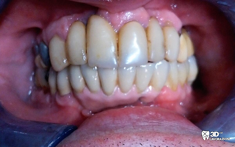 Metallo – ceramica 2 📍